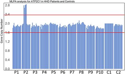 A Novel Microduplication Spanning Exons 8–16 of ATP2C1 That Was Undetectable by Standard Sanger Sequencing in a Japanese Patient With Hailey–Hailey Disease